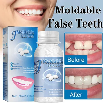 1PC שן זמני ערכת תיקון שיניים תותבות דבק מוצק תותבות על חסר שיניים שבורות Moldable שן מילוי שיניים תותבות כלי