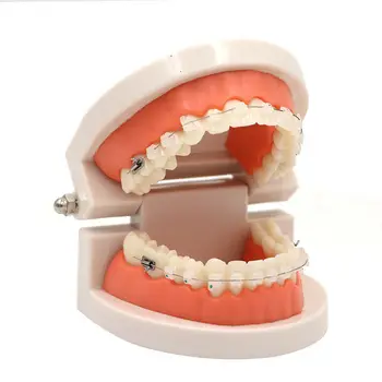 1pcs שיניים מלמד מודל המחקר ליישור שיניים הדגם עם קרמיקה הסוגריים המסולסלים באיכות גבוהה למבוגרים Typodont מודל