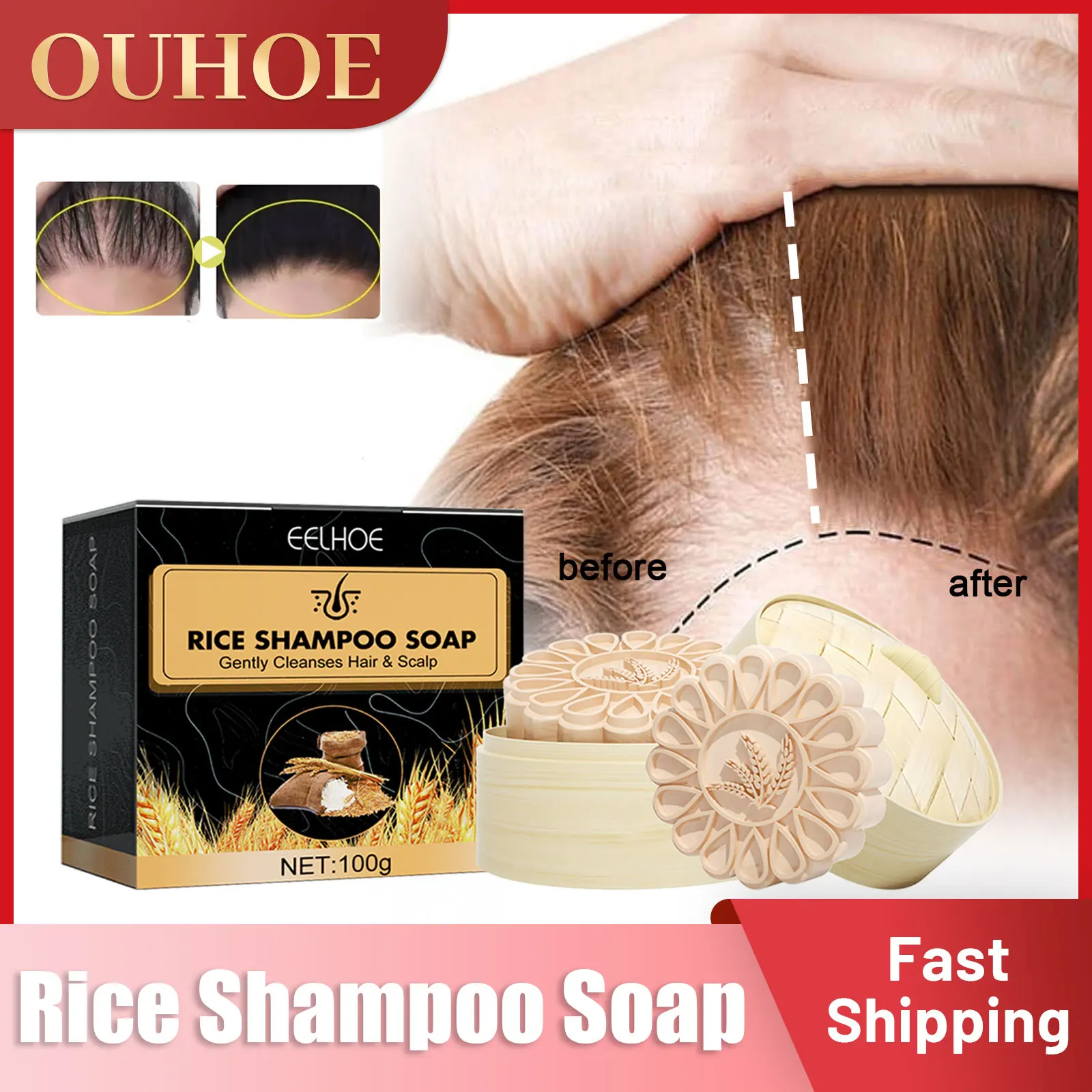 אורז נגד אובדן שמפו סבון להזין שיפור התקרחות לצמיחה מחודשת שיער הסרת קשקשים לחות השיער שמפו טיפולי - 0