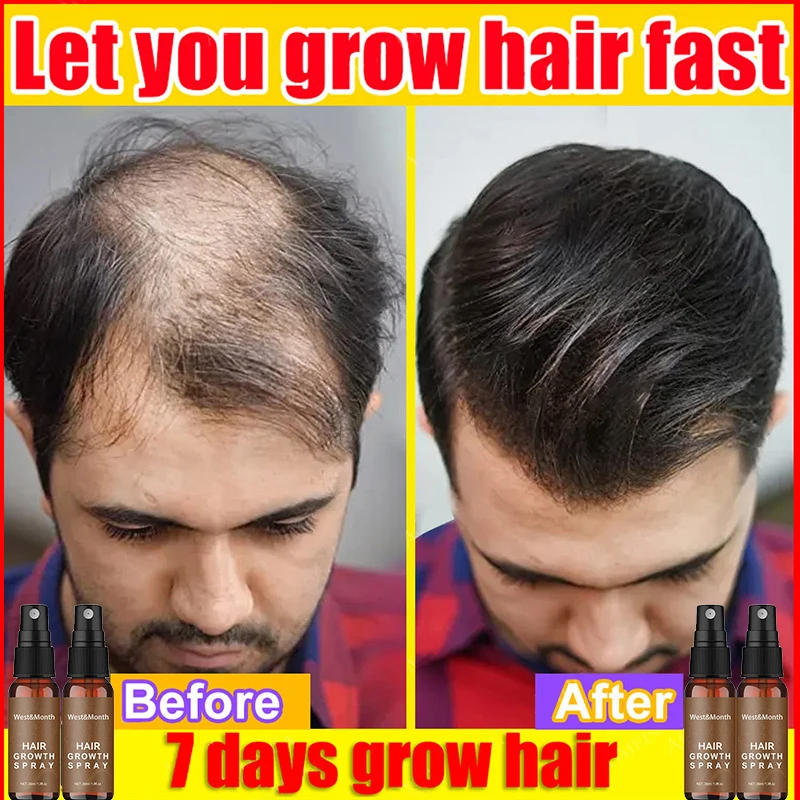 ג ' ינג ' ר צמיחת השיער ספריי מהיר לגדול נגד נשירת שיער שמן אתרי למנוע התקרחות טיפול פגום תיקון HairCare בריאות יופי - 0