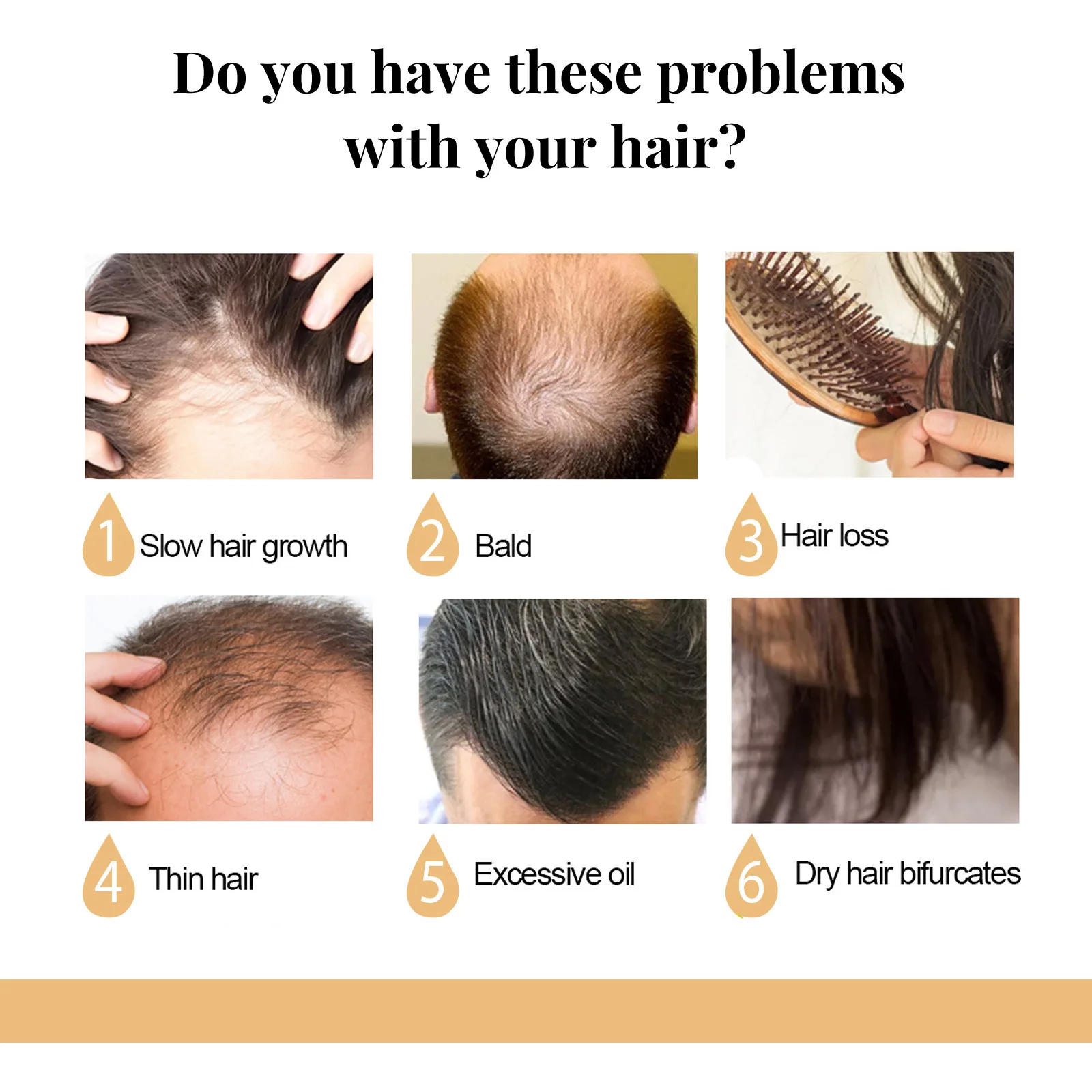 אורז נגד אובדן שמפו סבון להזין שיפור התקרחות לצמיחה מחודשת שיער הסרת קשקשים לחות השיער שמפו טיפולי - 5
